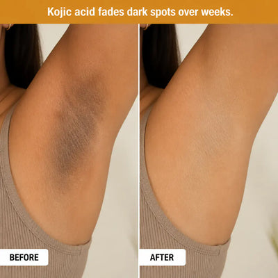 Premium Kojic Acid & Turmeric Spray