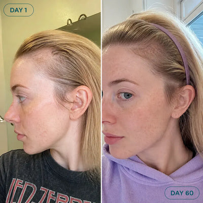 RootRoll - Scalp Serum Roll-On for Thinning Hair