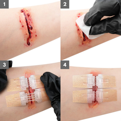 Ventra™ Advanced ZipClose Stitches