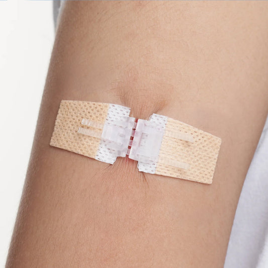 Ventra™ Advanced ZipClose Stitches