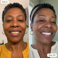 Premium Coconut Oil Whitening Strips