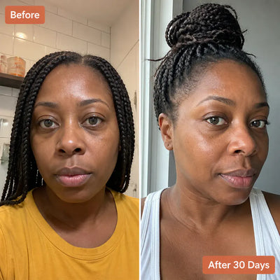 Ventra™ - Premium Calcium Dark Spot Eye Cream