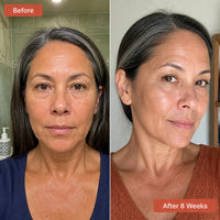 LiftShot Eye Serum: 0.1% Retinal + 3% Hyaluronic