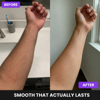 Ventra Men Premium Hair Removal Spray