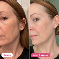 SilkTrim - Painless Trimmer for Sensitive Skin