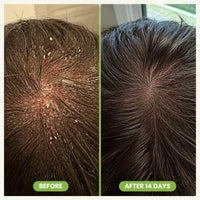 RegrowBar - Men's Hair Growth Shampoo Bar
