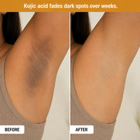 Premium Kojic Acid & Turmeric Spray