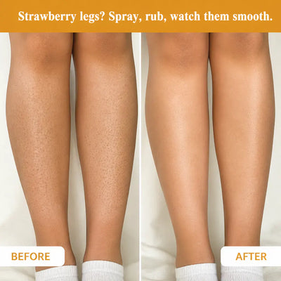 Premium Kojic Acid & Turmeric Spray