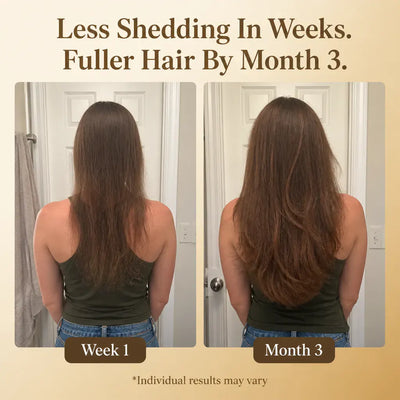 RootRevive - Hair Growth Vitamins