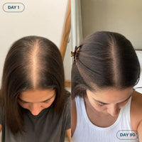 RootRoll - Scalp Serum Roll-On for Thinning Hair