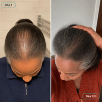 RootRoll - Scalp Serum Roll-On for Thinning Hair