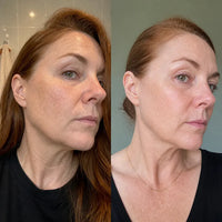 Ventra - Painless Trimmer for Sensitive Skin