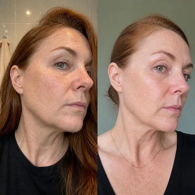 Ventra - Painless Trimmer for Sensitive Skin