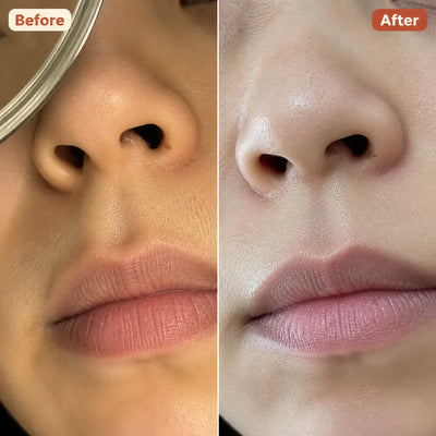 Ventra - Painless Trimmer for Sensitive Skin