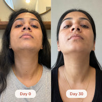 Ventra - Painless Trimmer for Sensitive Skin